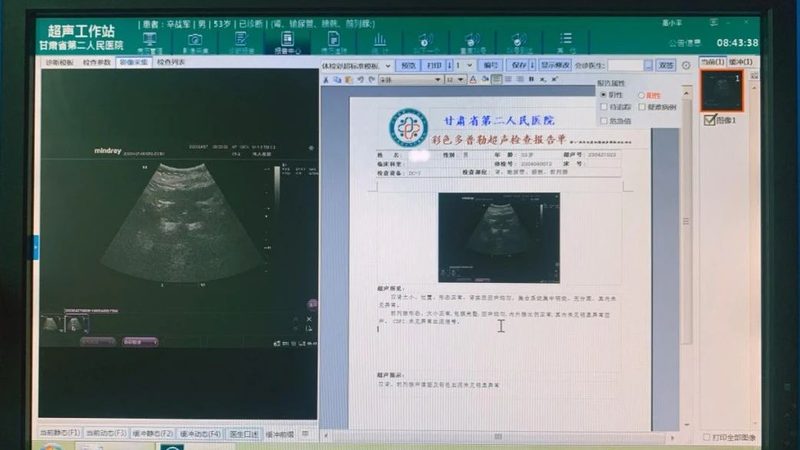 小学生入学体检，这些项目不能少**